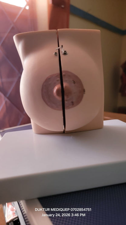 MODEL BREAST
