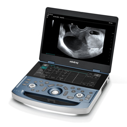 Mindray MX7 Full Digital 3d Laptop Color Doppler Ultrasound Diagnostic System With Printer