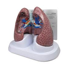 MODEL LUNG